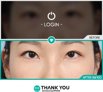 Before/After