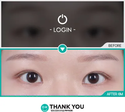 Before/After