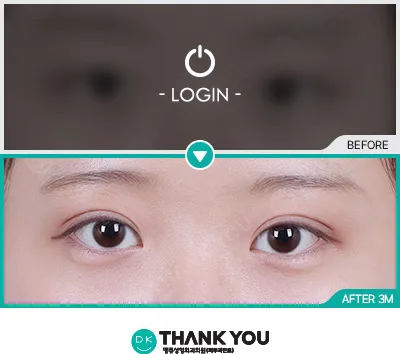 Before/After