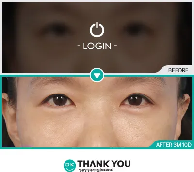 Before/After