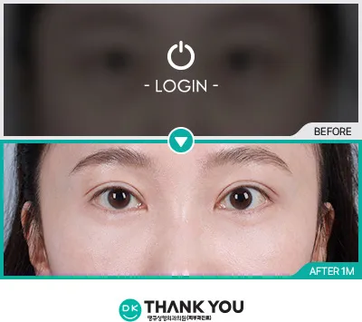 Before/After