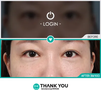 Before & After