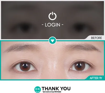 Before/After