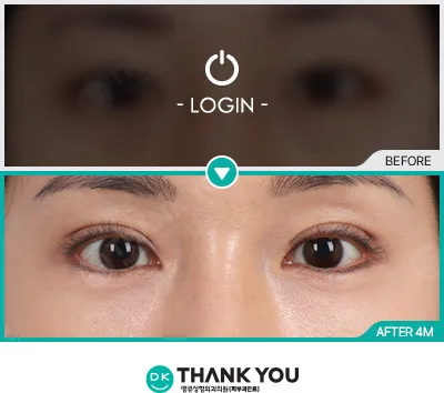 Before/After