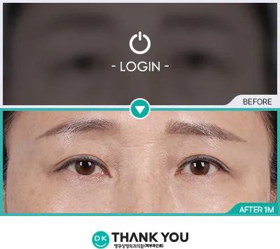 Before/After