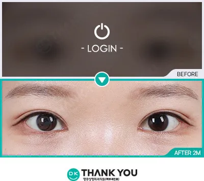 Before/After