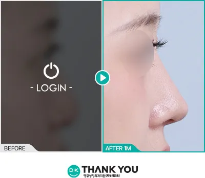 Before/After