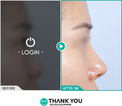 Before/After