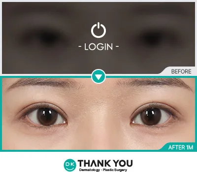 Before/After