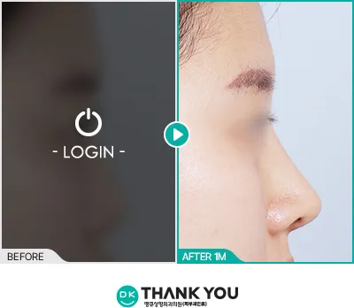 Before/After
