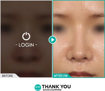 Before/After