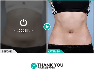 Before/After