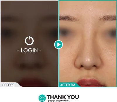 Before/After