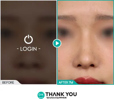 Before/After