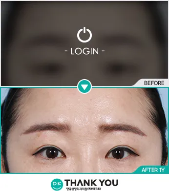 Before/After