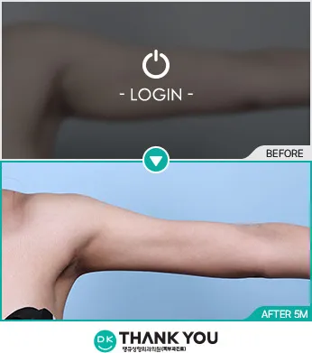 Before/After
