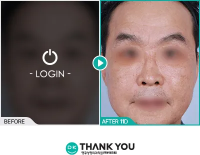 Before/After
