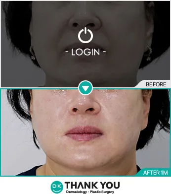 Before & After