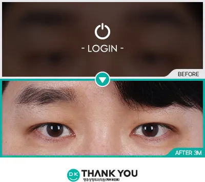 Before/After