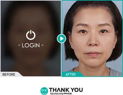 Before/After