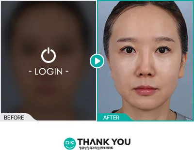 Before/After