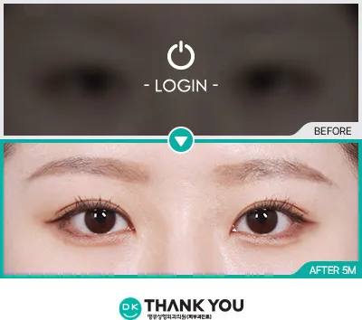 Before/After