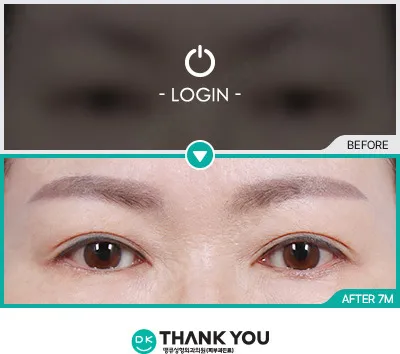 Before & After