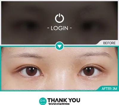 Before & After