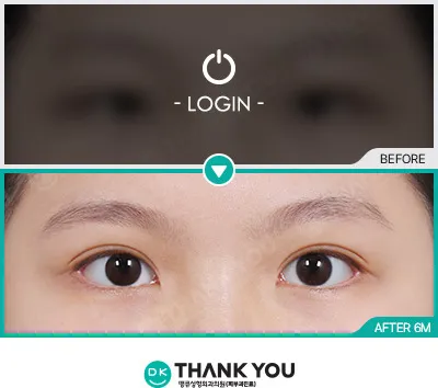 Before/After