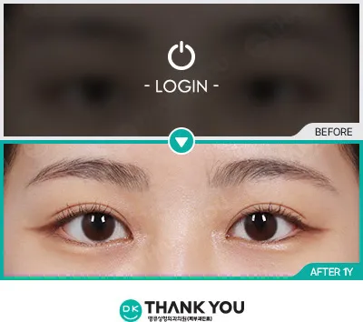 Before/After