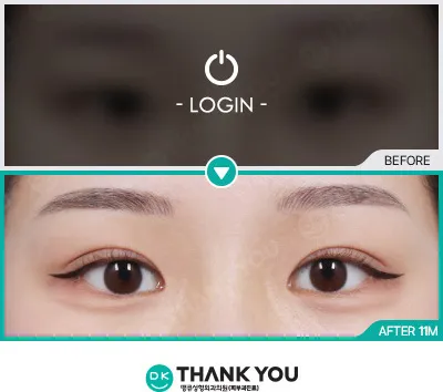 Before/After