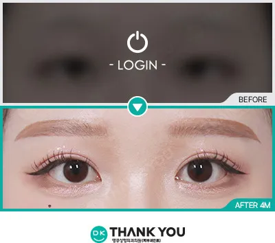 Before/After
