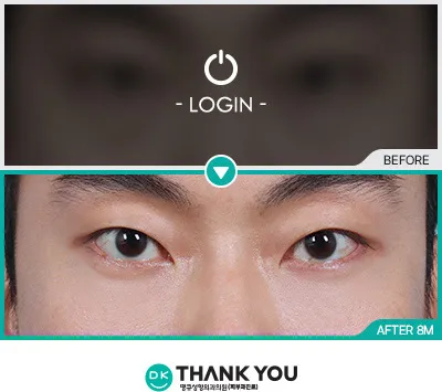 Before/After