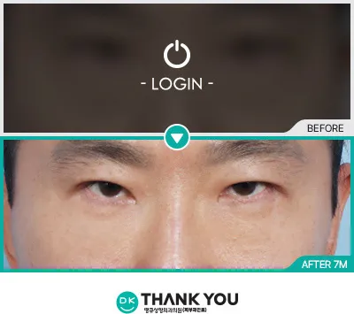 Before/After