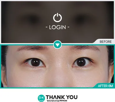 Before/After