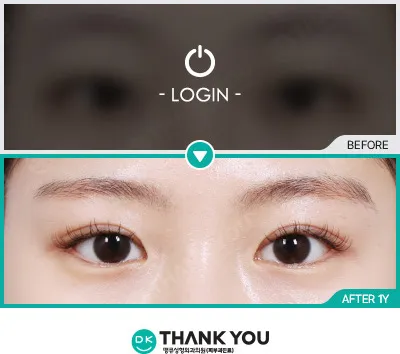 Before/After