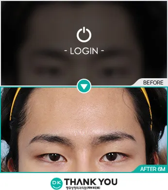 Before & After
