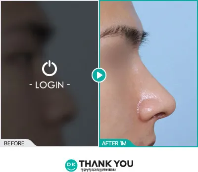 Before/After