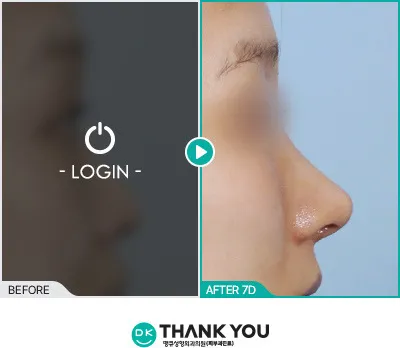 Before/After