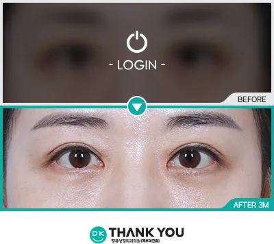 Before/After
