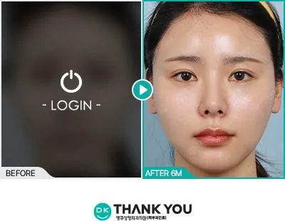Before/After