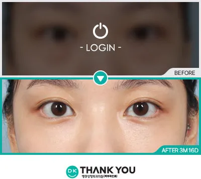 Before/After