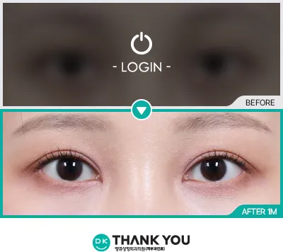 Before/After