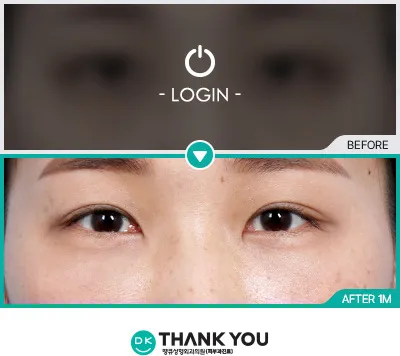 Before & After
