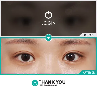 Before/After