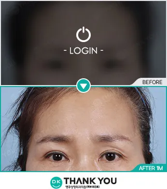 Before/After