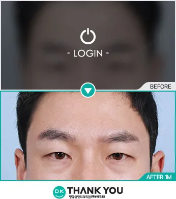 Before/After