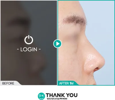 Before/After