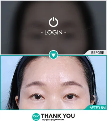 Before/After