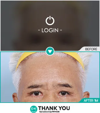 Before/After